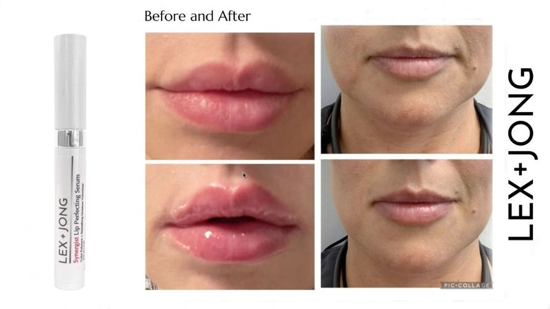 Synergist Lip Perfecting Serum hydrating and volumizing / plumping visible lip line smoother before and after results photos of real clients 1